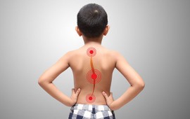 Manejo ortopédico da escoliose infantil: técnicas de tratamento não cirúrgicas e avaliação do risco-benefício da cirurgia